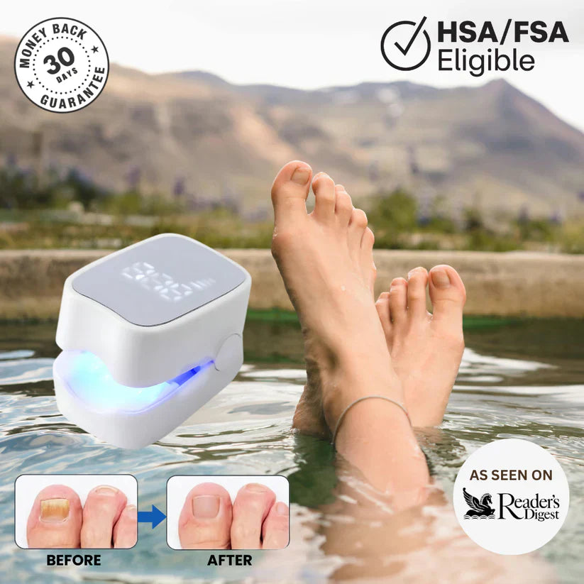 GraboraNail Pro™: The Revolutionary Laser Device for At-Home Nail Fungus Treatment