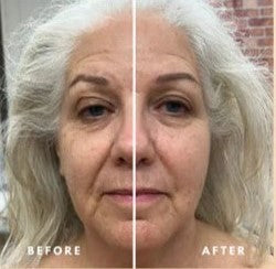 Grabora™ Lymphatic Face Brush